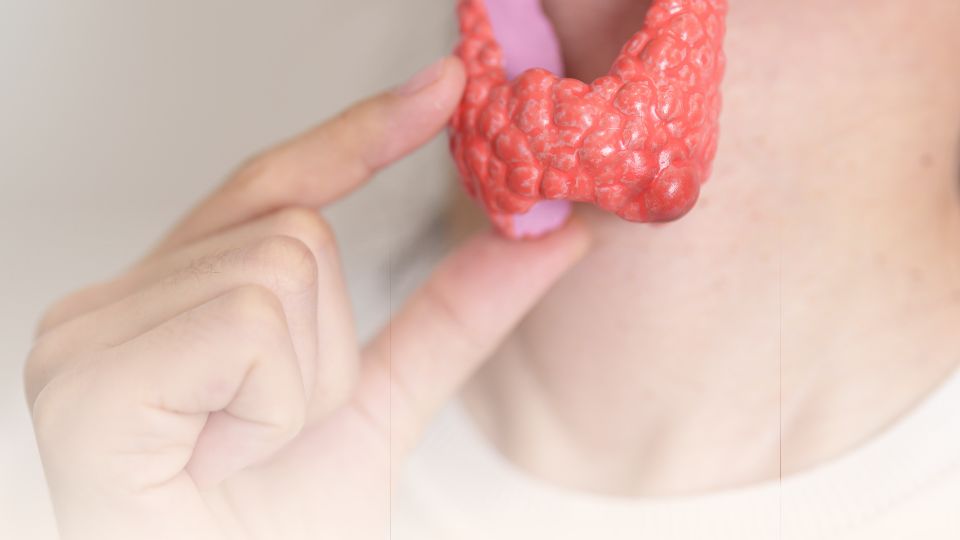 hashimoto-thyreoditis-ivonne-adamsde